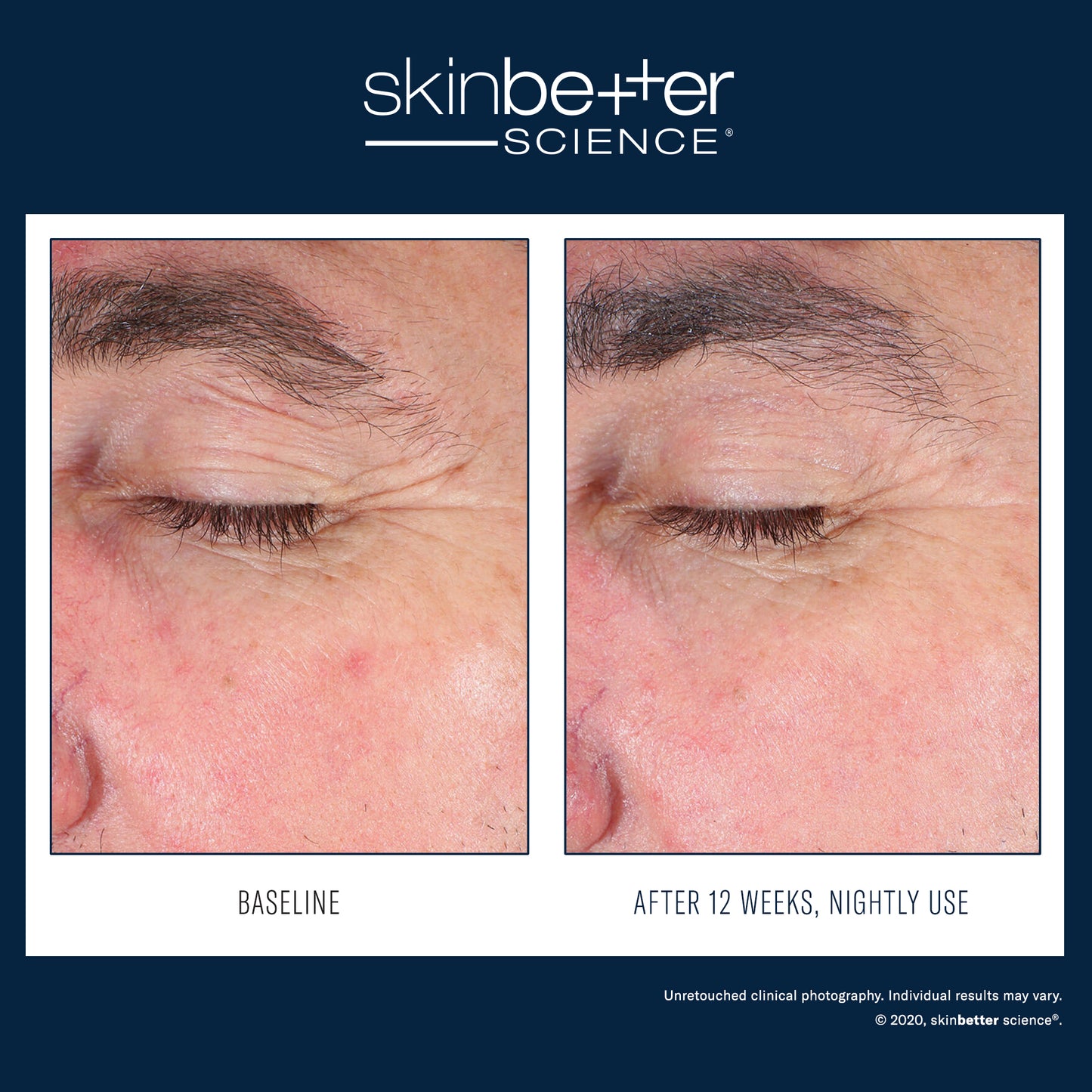 EyeMax AlphaRet Overnight Cream
