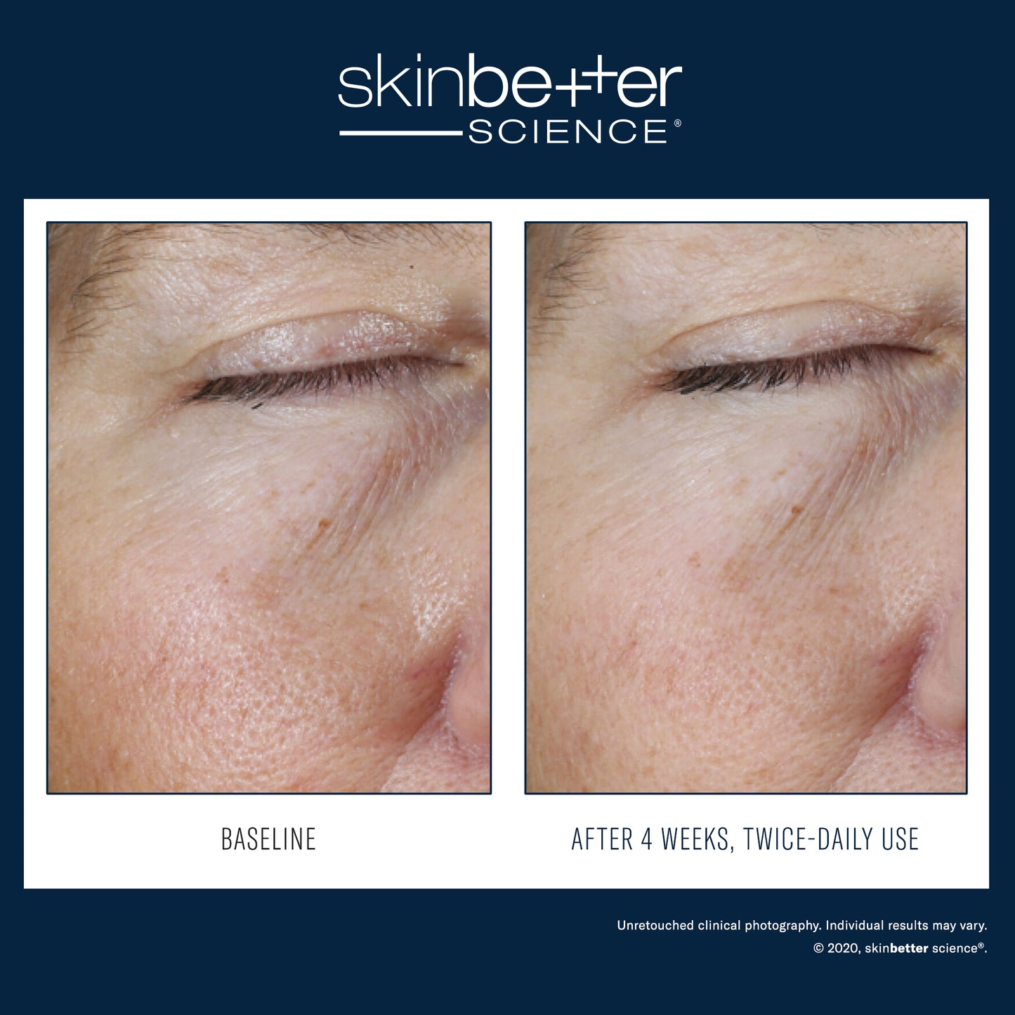 Instant Effect Gel EYE