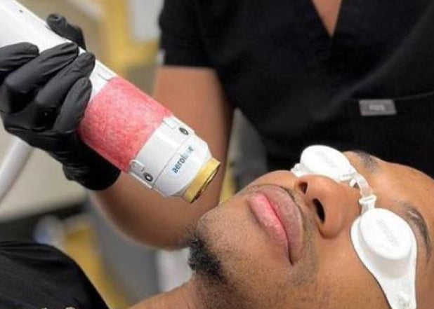 A close-up of a man receiving a cosmetic or skincare treatment, lying down with protective eye shields on his eyes while a gloved hand holds a handheld device against his face. The person is wearing a black scrub top, and the treatment device is white with a pink/red treatment head.