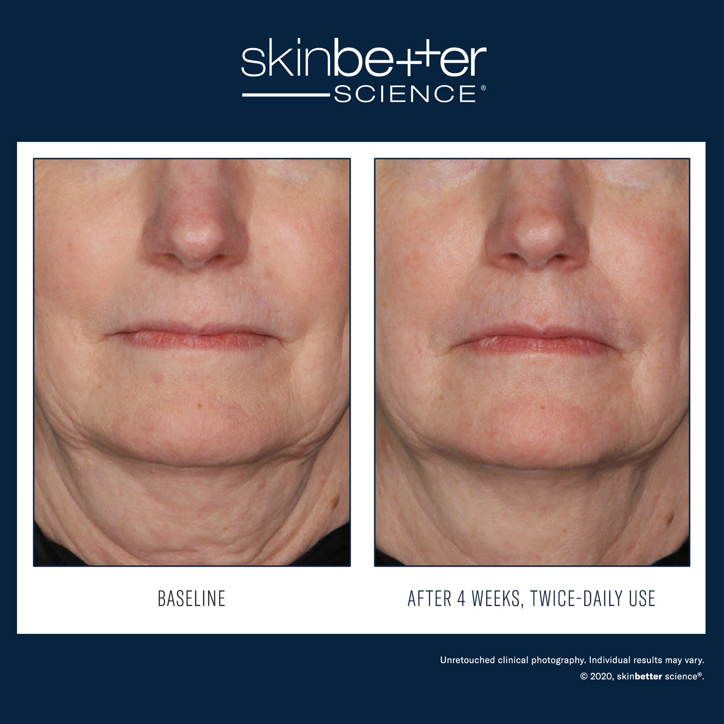 InterFuse Treatment Cream FACE & NECK