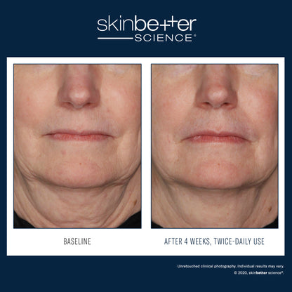 InterFuse Treatment Cream FACE & NECK