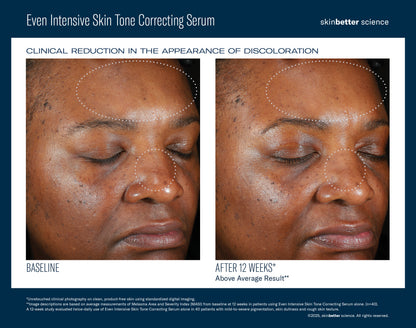 Even Intensive Skin Tone Correcting Serum
