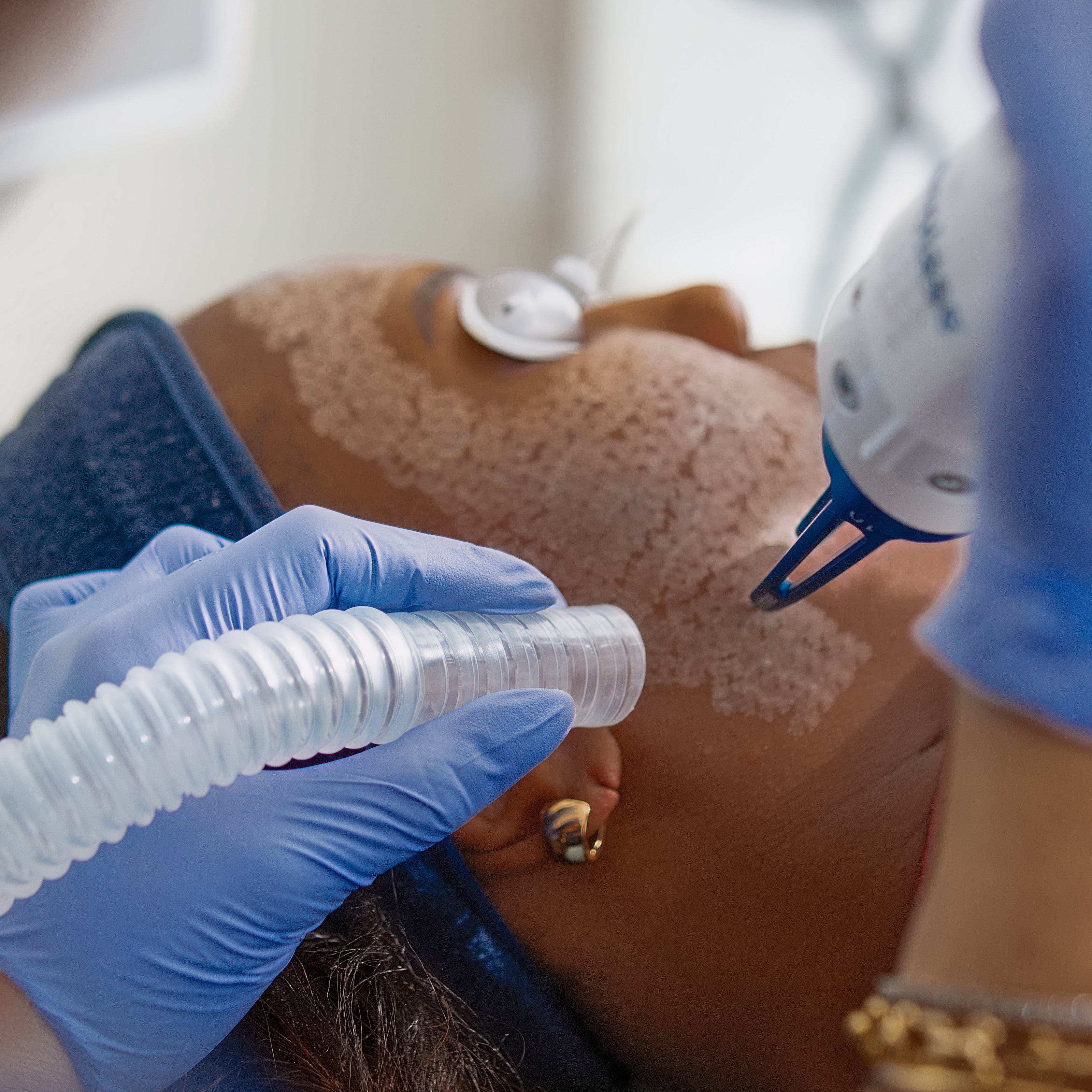 Person wearing blue gloves using a veterinary anesthetic machine on a patient.